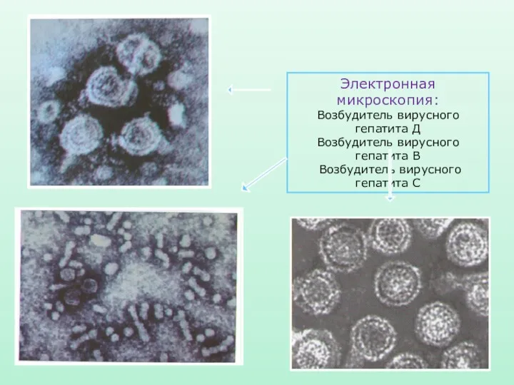 Электронная микроскопия: Возбудитель вирусного гепатита Д Возбудитель вирусного гепатита В Возбудитель вирусного гепатита С