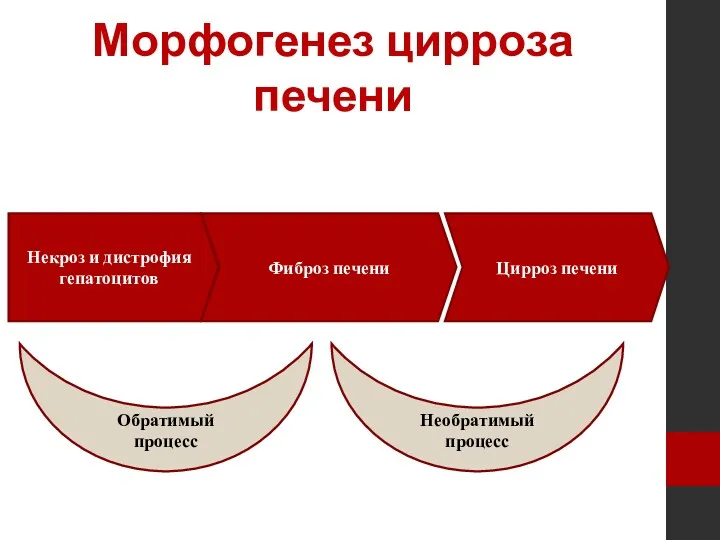 Морфогенез цирроза печени Некроз и дистрофия гепатоцитов Фиброз печени Цирроз печени Обратимый процесс Необратимый процесс