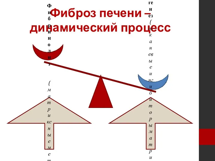 Фиброз печени – динамический процесс Фибринолиз (матриксные металлопро-теиназы) Фиброгенез (тканевые ингибиторы матриксных металлопро-теиназ)