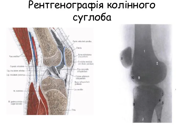 Рентгенографія колінного суглоба