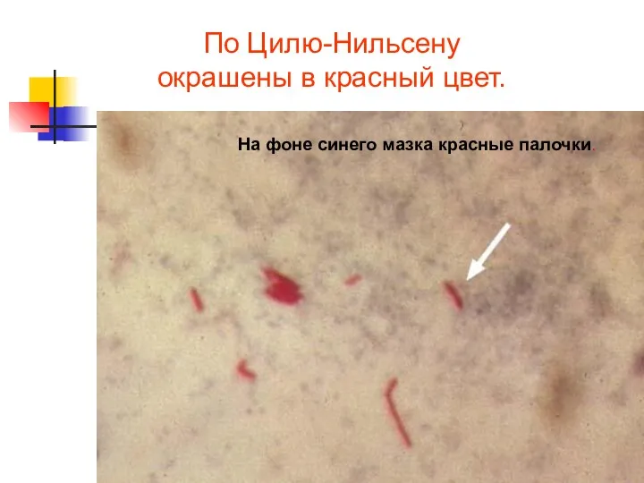 По Цилю-Нильсену окрашены в красный цвет. На фоне синего мазка красные палочки.