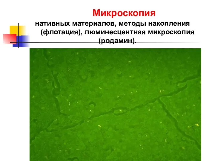 нативных материалов, методы накопления (флотация), люминесцентная микроскопия (родамин). Микроскопия