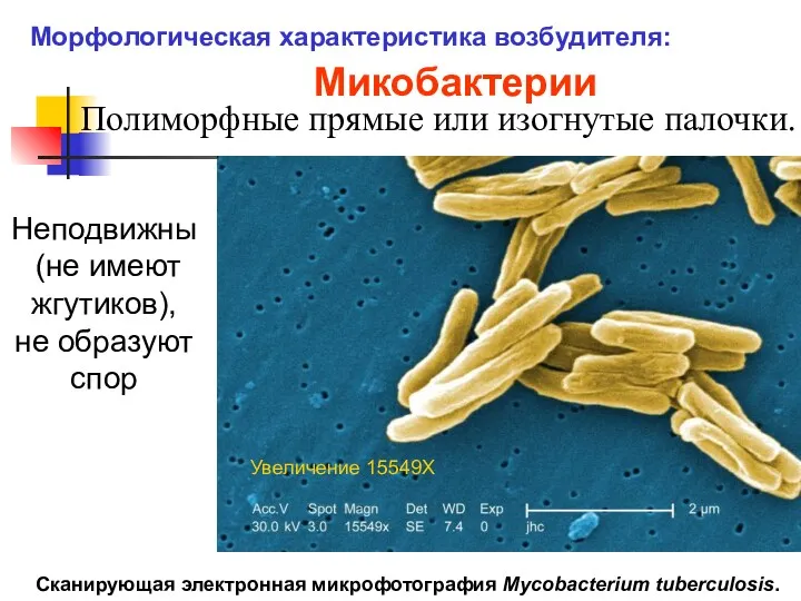 Полиморфные прямые или изогнутые палочки. Микобактерии Сканирующая электронная микрофотография Mycobacterium