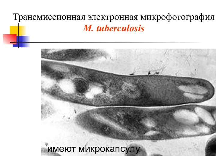 Трансмиссионная электронная микрофотография M. tuberculosis имеют микрокапсулу