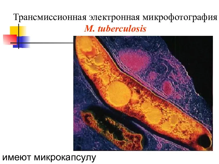 Трансмиссионная электронная микрофотография M. tuberculosis имеют микрокапсулу