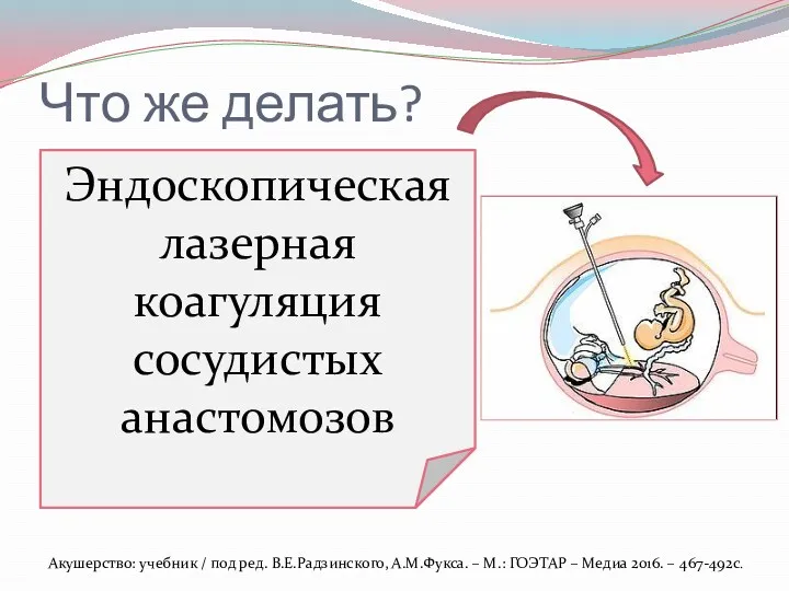 Что же делать? Амниоредукция Септостомия Селективная эвтаназия плода ? Эндоскопическая