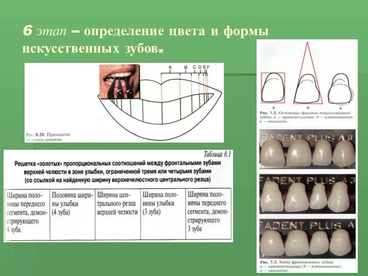 6 этап – определение цвета и формы искусственных зубов.