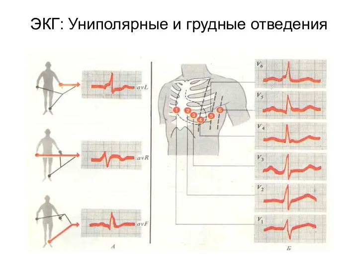 ЭКГ: Униполярные и грудные отведения