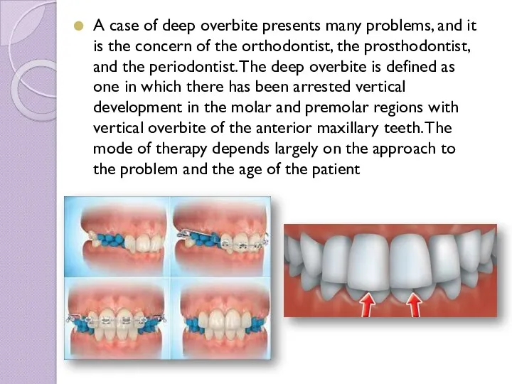 A case of deep overbite presents many problems, and it