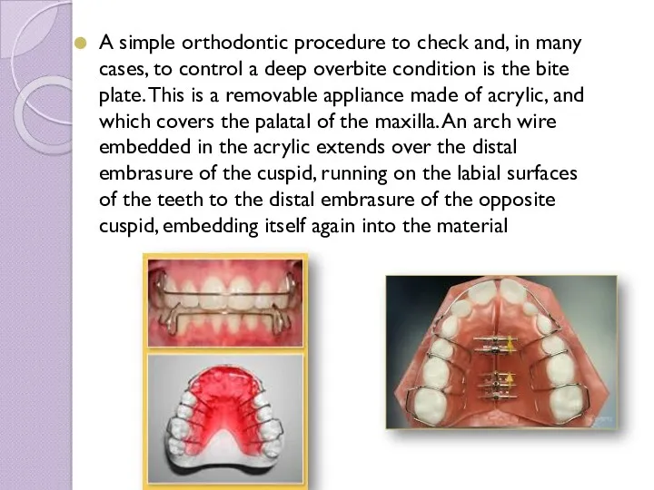 A simple orthodontic procedure to check and, in many cases,