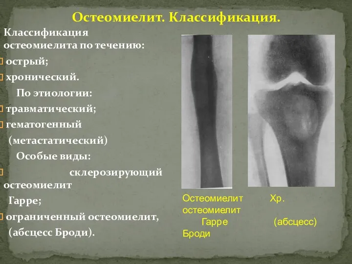 Остеомиелит. Классификация. Классификация остеомиелита по течению: острый; хронический. По этиологии: