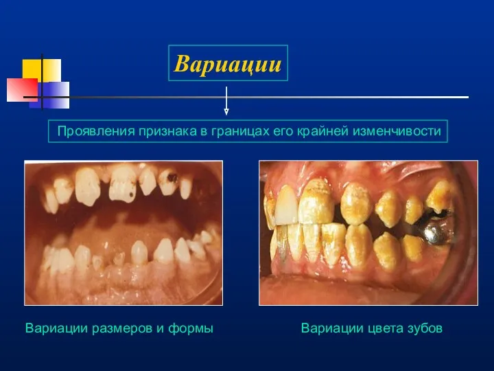 Вариации Проявления признака в границах его крайней изменчивости Вариации цвета зубов Вариации размеров и формы