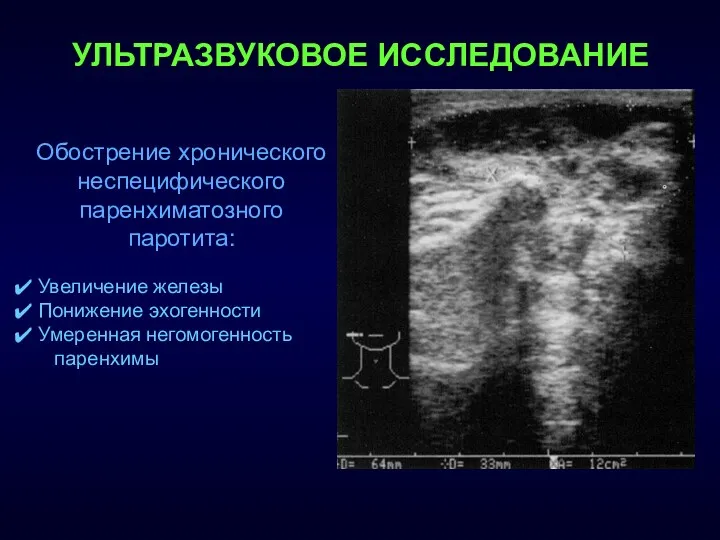 Обострение хронического неспецифического паренхиматозного паротита: Увеличение железы Понижение эхогенности Умеренная негомогенность паренхимы УЛЬТРАЗВУКОВОЕ ИССЛЕДОВАНИЕ