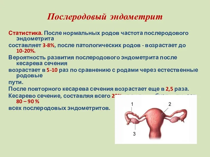 Послеродовый эндометрит Статистика. После нормальных родов частота послеродового эндометрита составляет