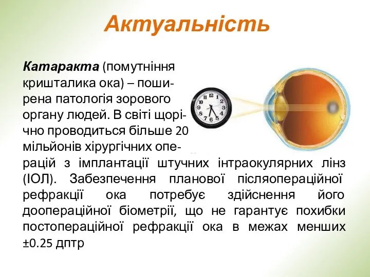 Актуальність Катаракта (помутніння кришталика ока) – поши- рена патологія зорового