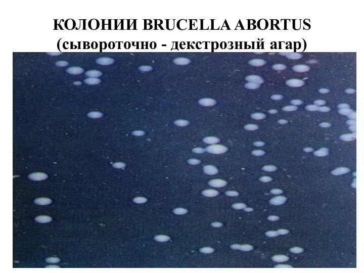 КОЛОНИИ BRUCELLA ABORTUS (сывороточно - декстрозный агар)