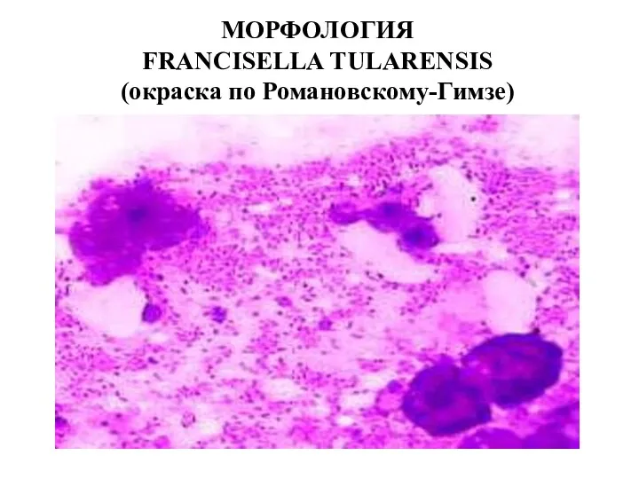 МОРФОЛОГИЯ FRANCISELLA TULARENSIS (окраска по Романовскому-Гимзе)