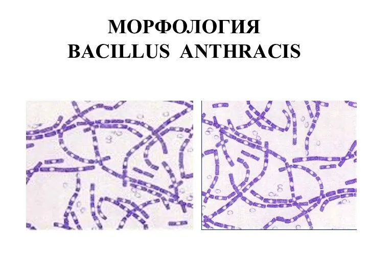 МОРФОЛОГИЯ BACILLUS ANTHRACIS