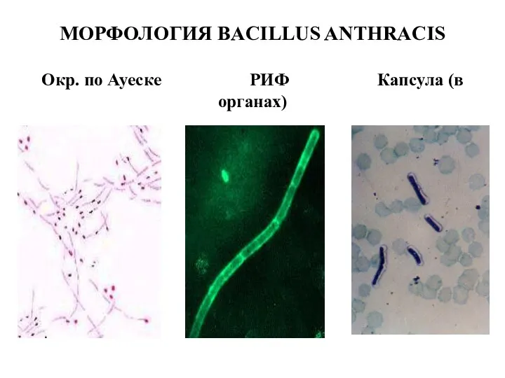 МОРФОЛОГИЯ BACILLUS ANTHRACIS Окр. по Ауеске РИФ Капсула (в органах)