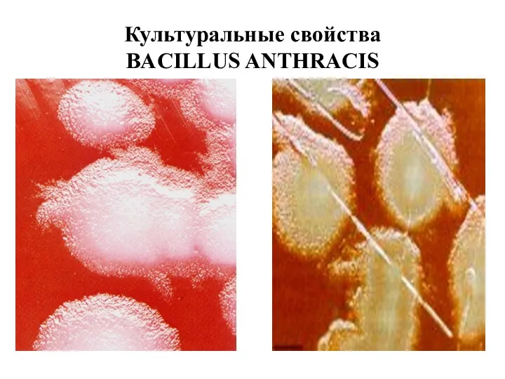 Культуральные свойства BACILLUS ANTHRACIS