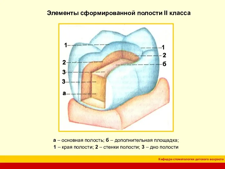 Элементы сформированной полости II класса а – основная полость; б