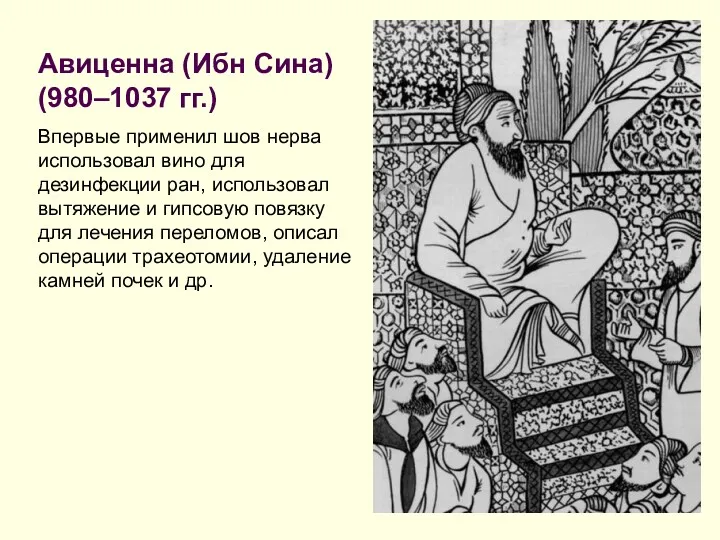 Авиценна (Ибн Сина) (980–1037 гг.) Впервые применил шов нерва использовал