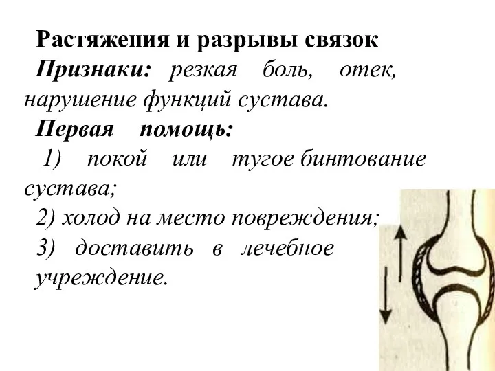 Растяжения и разрывы связок Признаки: резкая боль, отек, нарушение функций