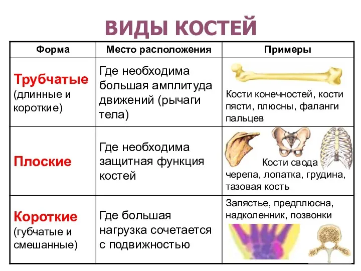 ВИДЫ КОСТЕЙ