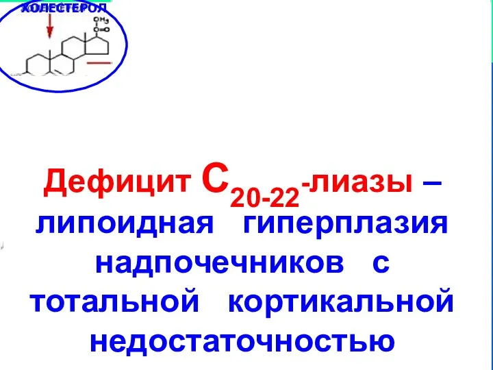 Дефицит С20-22-лиазы – липоидная гиперплазия надпочечников с тотальной кортикальной недостаточностью ХОЛЕСТЕРОЛ