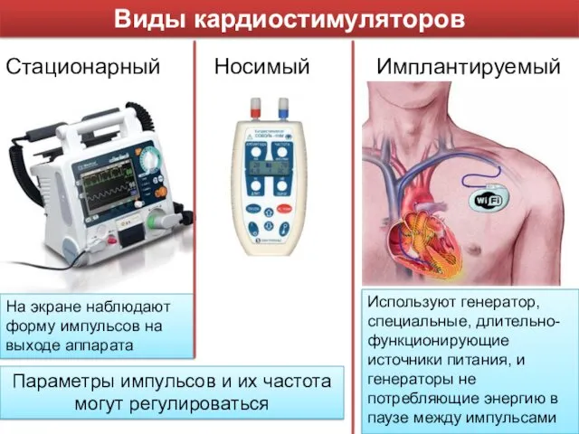 Виды кардиостимуляторов Стационарный Носимый Имплантируемый На экране наблюдают форму импульсов