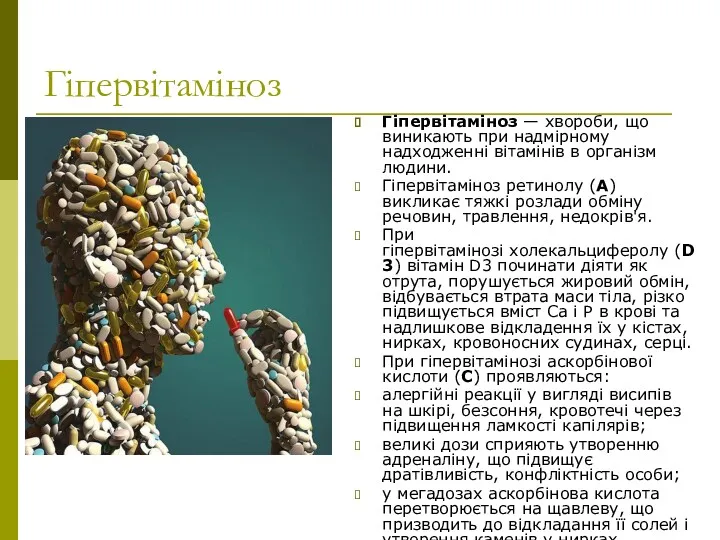 Гіпервітаміноз Гіпервітаміноз — хвороби, що виникають при надмірному надходженні вітамінів