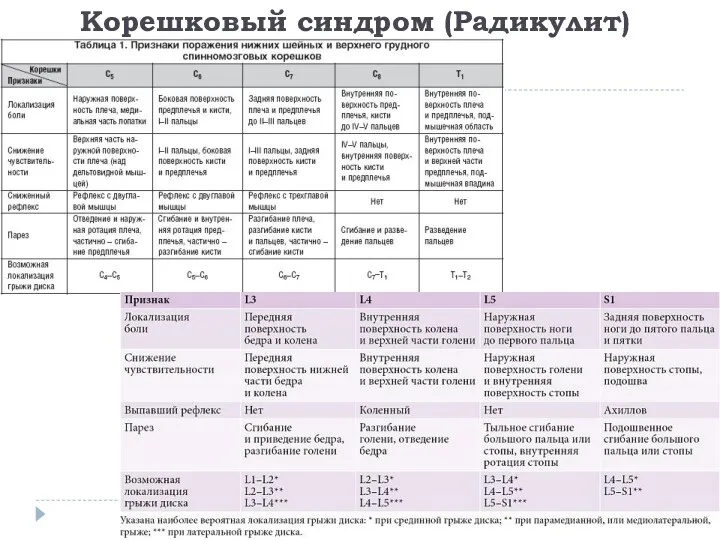 Корешковый синдром (Радикулит)