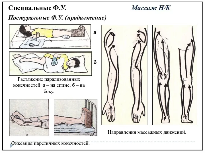 Специальные Ф.У. Массаж Н/К Постуральные Ф.У. (продолжение)‏ Растяжение парализованных конечностей: