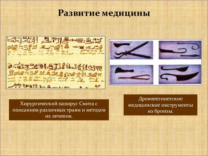 Древнеегипетские медицинские инструменты из бронзы. Развитие медицины Хирургический папирус Смита с описанием различных