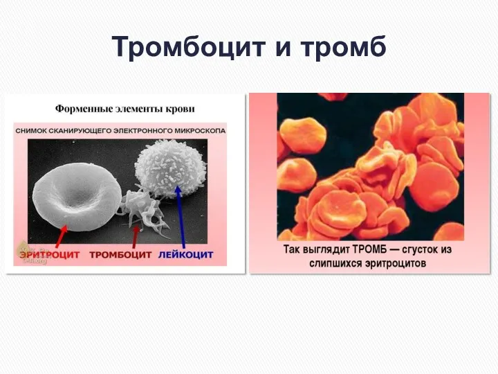 Тромбоцит и тромб