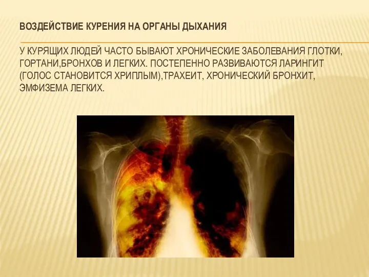 ВОЗДЕЙСТВИЕ КУРЕНИЯ НА ОРГАНЫ ДЫХАНИЯ У КУРЯЩИХ ЛЮДЕЙ ЧАСТО БЫВАЮТ