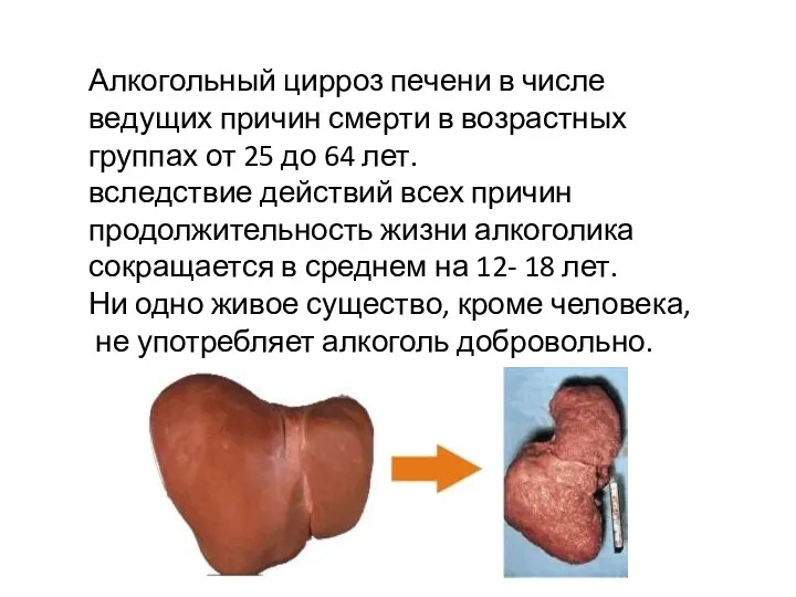 Алкогольный цирроз печени в числе ведущих причин смерти в возрастных