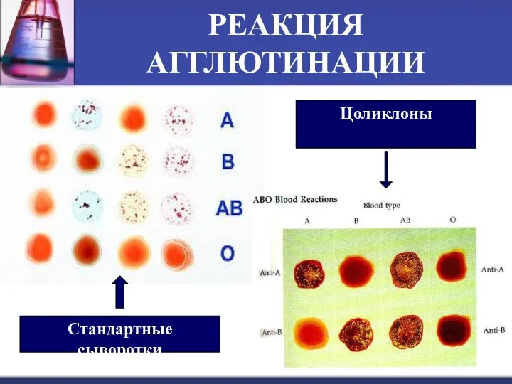 РЕАКЦИЯ АГГЛЮТИНАЦИИ Стандартные сыворотки Цоликлоны