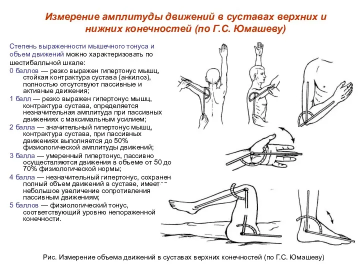 Степень выраженности мышечного тонуса и объем движений можно характеризовать по