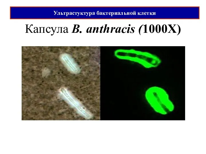 Капсула B. anthracis (1000X) Ультрастуктура бактериальной клетки