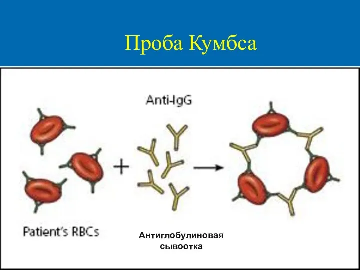 Проба Кумбса Антиглобулиновая сывоотка