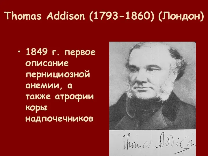 Thomas Addison (1793-1860) (Лондон) 1849 г. первое описание пернициозной анемии, а также атрофии коры надпочечников