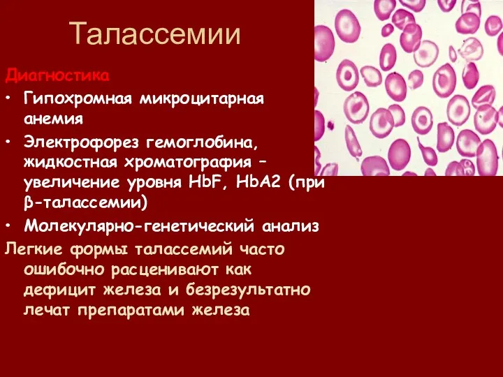 Талассемии Диагностика Гипохромная микроцитарная анемия Электрофорез гемоглобина, жидкостная хроматография –