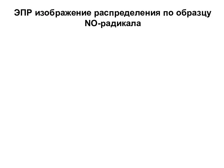 ЭПР изображение распределения по образцу NO-радикала