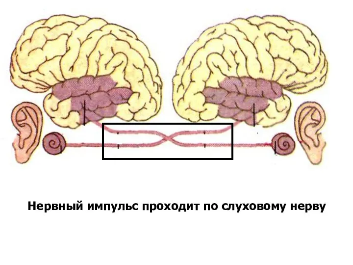 Нервный импульс проходит по слуховому нерву