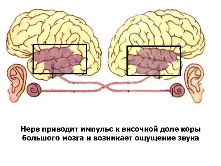 Нерв приводит импульс к височной доле коры большого мозга и возникает ощущение звука