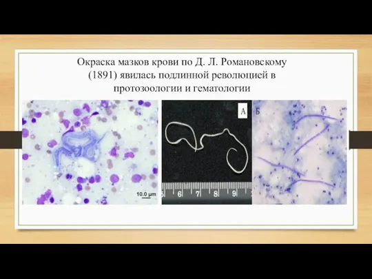 Окраска мазков крови по Д. Л. Романовскому (1891) явилась подлинной революцией в протозоологии и гематологии