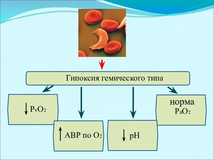 Гипоксия гемического типа PvO2 pH РаO2 АВР по O2 норма