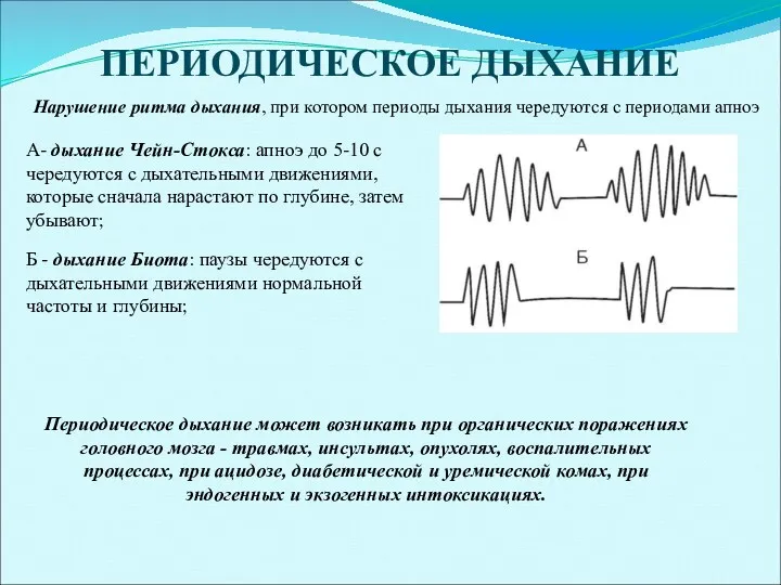 ПЕРИОДИЧЕСКОЕ ДЫХАНИЕ Нарушение ритма дыхания, при котором периоды дыхания чередуются