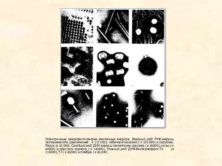 Электронные микрофотографии различных вирусов. Верхний ряд: РНК-вирусы полиомиелита (увеличение х